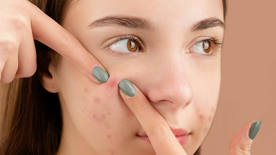 obesity skin health skin problems due to obesity skin conditions caused by being overweight dermatologist skin care for obese people prevent acne psoriasis stretch marks skin folds friction fungal infection wound healing hydration dry skin atopic dermatitis obesity and hormonal imbalance inflammation healthy diet for