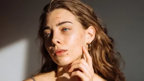 stress and skin health stress and acne stress and hair loss stress and ageing dermatologists tips for stress skin care anxiety skin problems stress eczema flare ups stress and psoriasis stress and rosacea stress and hyperpigmentation stress wrinkles stress and collagen stress hormones cortisol stress and pimples stress and oily skin stress related hair shedding stress and sensitive skin stress and dryness stress and melasma stress and rashes stress induced breakouts stress related skin issues dermatologist stress advice stress and premature ageing anxiety skin flare ups stress beauty tips stress effects on face stress induced hair thinning stress hormone imbalance skin stress and pigmentation dermatologist skincare tips stress and fine lines stress and inflammation stress relief for skin stress and dark patches stress and dull skin stress and acne scars stress and scalp issues stress related itching stress and skin irritation stress induced skin disorders dermatologist advice for stress stress management for glowing skin stress and dark circles stress treatment for hair loss stress and uneven skin tone stress and skincare routine