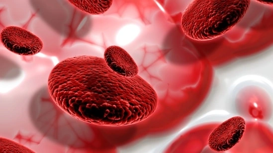 aplast ic anemia disease aplastic anemia symptoms aplastic anemia causes bone marrow failure disease rare blood disorder symptoms aplastic anemia treatment stem cell transplant anemia aplastic anemia diagnosis bone marrow biopsy anemia symptoms fatigue shortness of breath anemia low blood cells disease aplastic