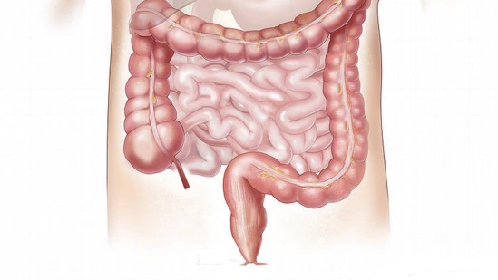 right sided colon cancer symptoms colon cancer warning signs colorectal cancer early signs hidden cancer symptoms colon cancer fatigue unexplained weight loss cancer abdominal bloating cancer bowel habit changes colon cancer anaemia symptoms colon