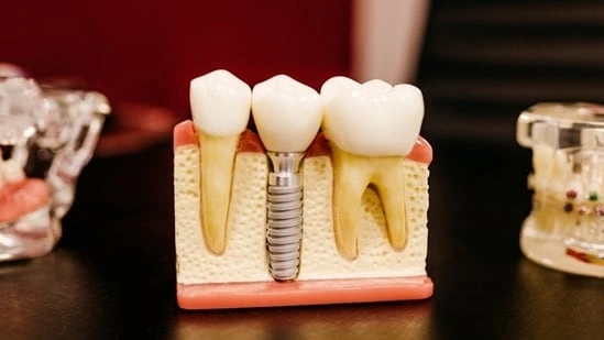 teeth health signs oral health warning signs gum bleeding heart disease dry mouth diabetes tooth erosion GERD mouth ulcers immunity loose teeth osteoporosis dental