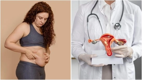 ovarian cancer risk women obesity and cancer link ovarian cancer causes obesity health risks women hormonal imbalance cancer risk metabolic syndrome ovarian cancer